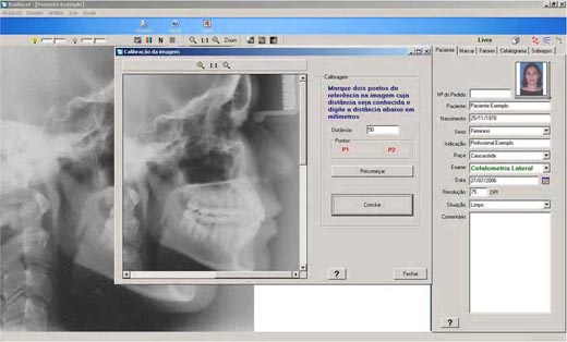 software Documentação odontológica - calibragem