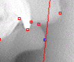 Cefalometria computadorizada - Ferramenta Perpendicular