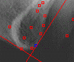Cefalometria computadorizada - Ferramenta Perpendicular