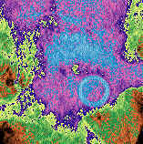 Cefalometria computadorizada - Imagem com o efeito Pseudo-Coloração
