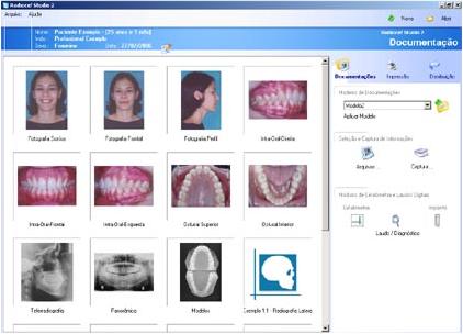 Cefalometria computadorizada - software