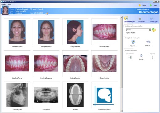 Documentação odontológica, Documentação interativa, software, impressão de relatórios, fichas, laudos, etiquetas